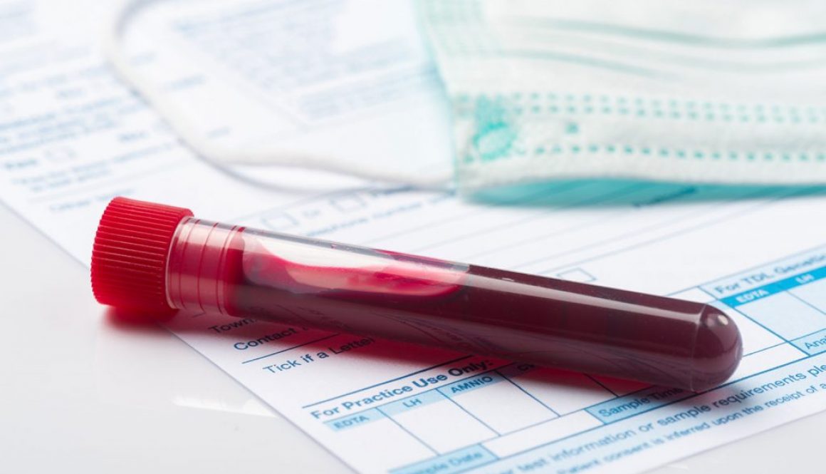 Lab blood work test tube