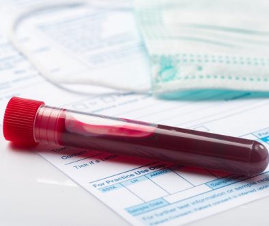 Lab blood work test tube