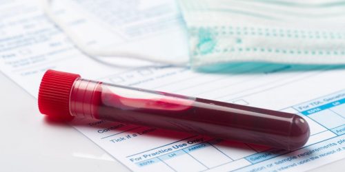 Lab blood work test tube