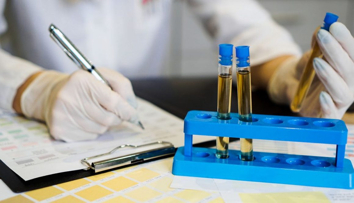Doctor holding urine test tube with chart taking notes