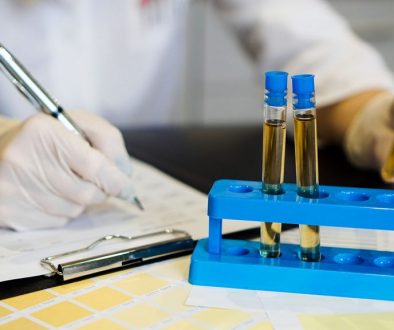Doctor holding urine test tube with chart taking notes