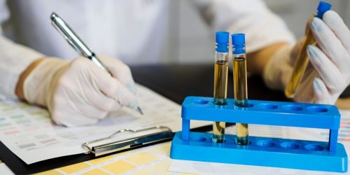 Doctor holding urine test tube with chart taking notes
